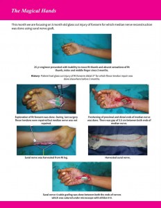 brachial plexus surgery in Nashik